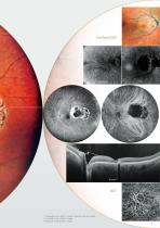 Scanning Laser Ophthalmoscope Mirante SLO/OCT Mirante SLO-3