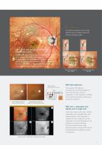 Scanning Laser Ophthalmoscope Mirante SLO/OCT Mirante SLO-5