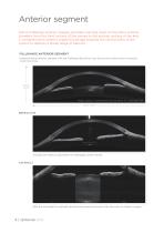 | optovue solix-4