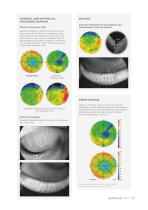 | optovue solix-5