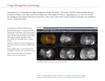 OptosAdvance-2