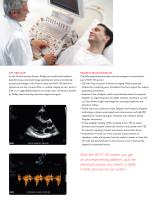 philips HD11 XE echocardiography system high definition ultrasound made simple - 3