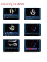 philips HD11 XE echocardiography system high definition ultrasound made simple - 9