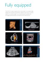 Philips HD11 XE ultrasound system-2