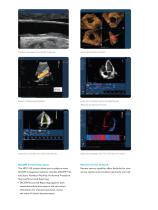 Philips HD11 XE ultrasound system-9
