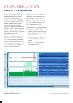medilog Holter system-4