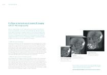 Ziehm Vision RFD 3D The revolution in 3D imaging-3