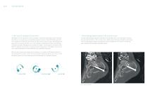 Ziehm Vision RFD 3D The revolution in 3D imaging-4