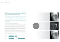 Ziehm Vision RFD 3D The revolution in 3D imaging-5