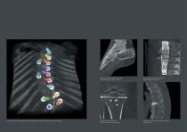 Ziehm Vision RFD 3D The revolution in 3D imaging-6