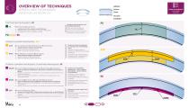 Keratoplasty catalogue - 4