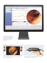 AURICAL OTOcam-3