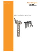 Volar Distal Radius Locking Plate - 1