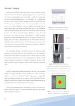 ShearWave Elastography - 6