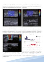 ShearWave Elastography - 8