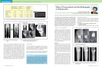 Clinical Applications to Orthopaedics by New X-ray Technology - 4