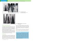 Clinical Applications to Orthopaedics by New X-ray Technology - 6