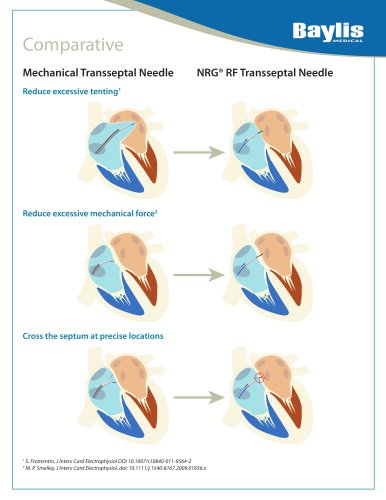 Comparative Mechanical Needle vs NRG® Transseptal Needle