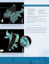 CARTOSound Image Integration Module with SOUNDSTAR Catheter - 3