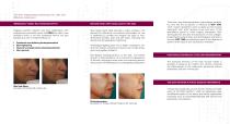 Regain a New Skin Tone and Glow-2