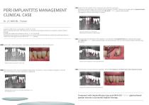 Prophylaxis - Peri-implantitis-8