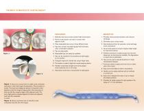 trimax-2