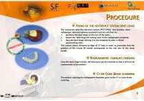 ProceduraPianificazioneImplantare2013-3