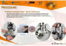 ProceduraPianificazioneImplantare2013-6