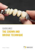 Guidelines – The Crown and Bridge Technique-1