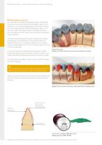 Guidelines – The Crown and Bridge Technique-6