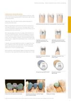 Guidelines – The Crown and Bridge Technique-7