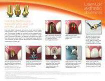 Laser-Lok ® e sthetic  abutments - 1