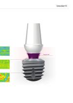 copaSKY – Implant System-11
