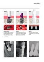 SKY Implant System – blueSKY, narrowSKY, classicSKY-9