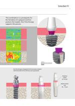 SKY Implant System – DNA – system presentation-11