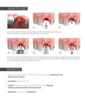 BTI Root Extractor - 3