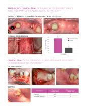 Kit PRGF – ENDORET® - Alveolus Post-Extraction - 4