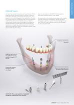 Product Catalog CAMLOG ® Implant System - 13