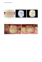 Dental Lab System - 16