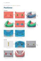 Overdenture System - 20