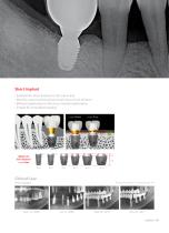 Product from Dentium - 15