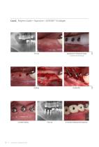 Surgical Guide SGCM-1312 [Rev.1] - 10