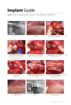 Surgical Guide SGCM-1312 [Rev.1] - 11