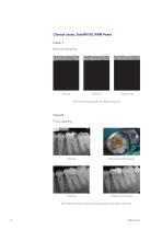 TotalFill® Premixed Bioceramic Materials - 13