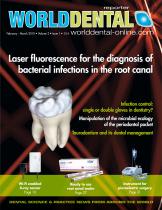 Laser dentistry: the Ideal Solution for Faster Treatment of More Patients-1