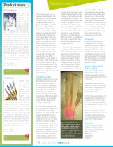 Laser dentistry: the Ideal Solution for Faster Treatment of More Patients-8