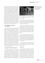 TwinLight? Laser Assisted Endodontics-2