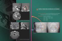 Morita 3D Accuitomo 170-13