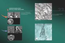 Morita 3D Accuitomo 170-14