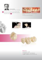 CAD-CAM Chairside - CEREC-9